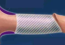 Penis kalınlaştırma kalıcı mıdır?